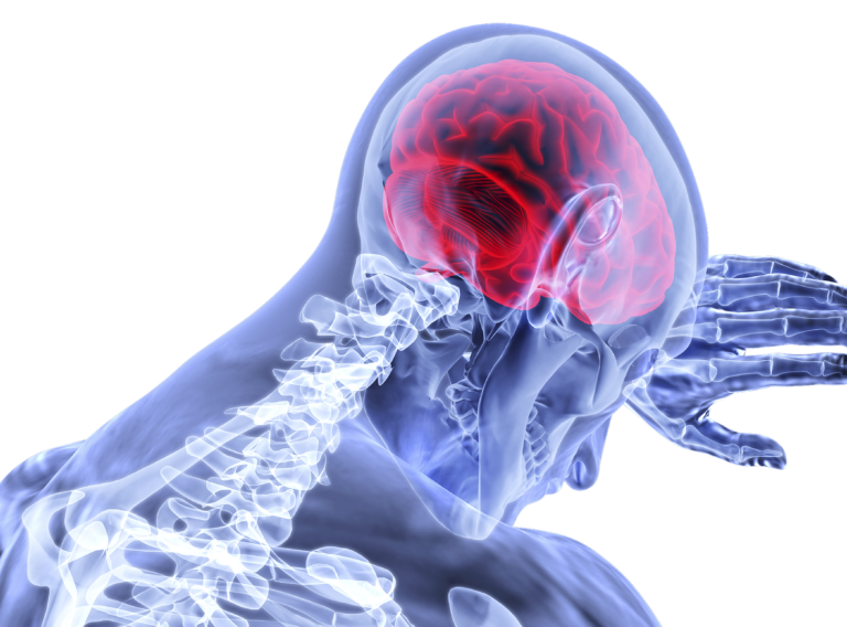 brain- brain-